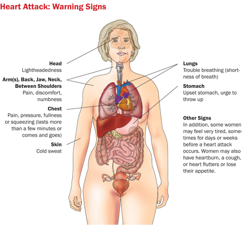 Heart Attack Symptoms