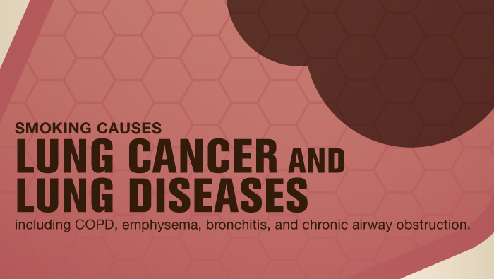 Smoking and lung disease