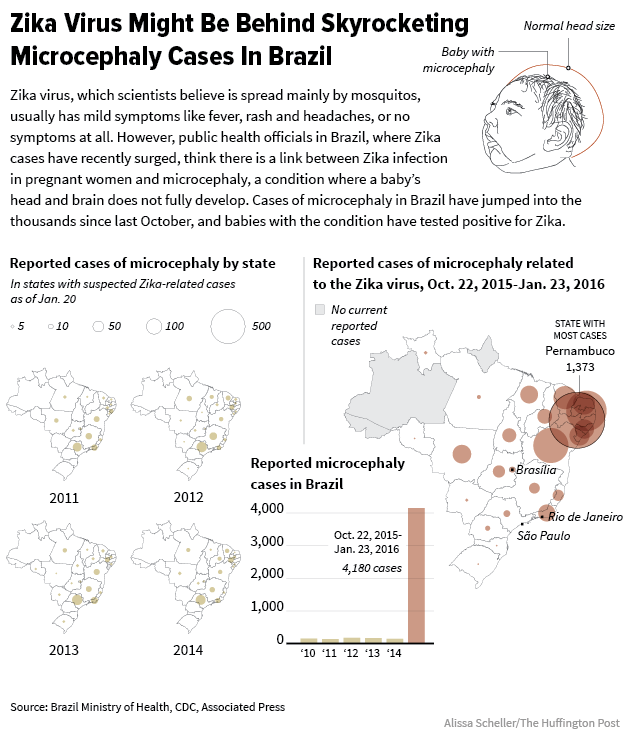 Microcephaly