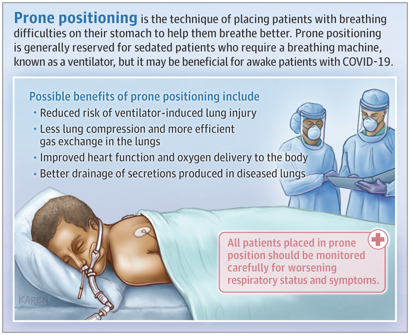 Prone positioning