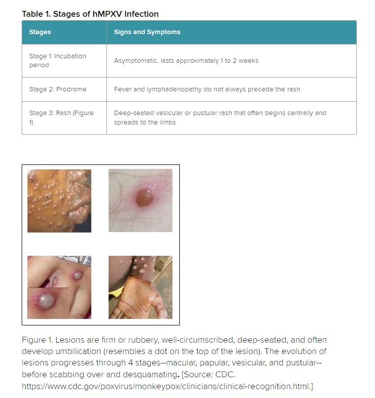 MPXV infection stages