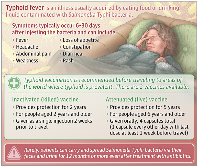 Typhoid Fever