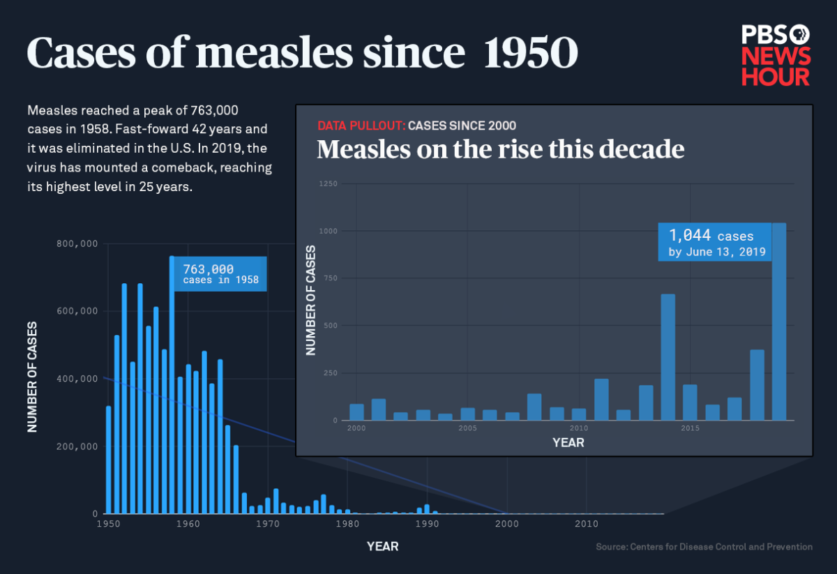 Measles history